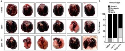 PEGylated Serp-1 Markedly Reduces Pristane-Induced Experimental Diffuse Alveolar Hemorrhage, Altering uPAR Distribution, and Macrophage Invasion